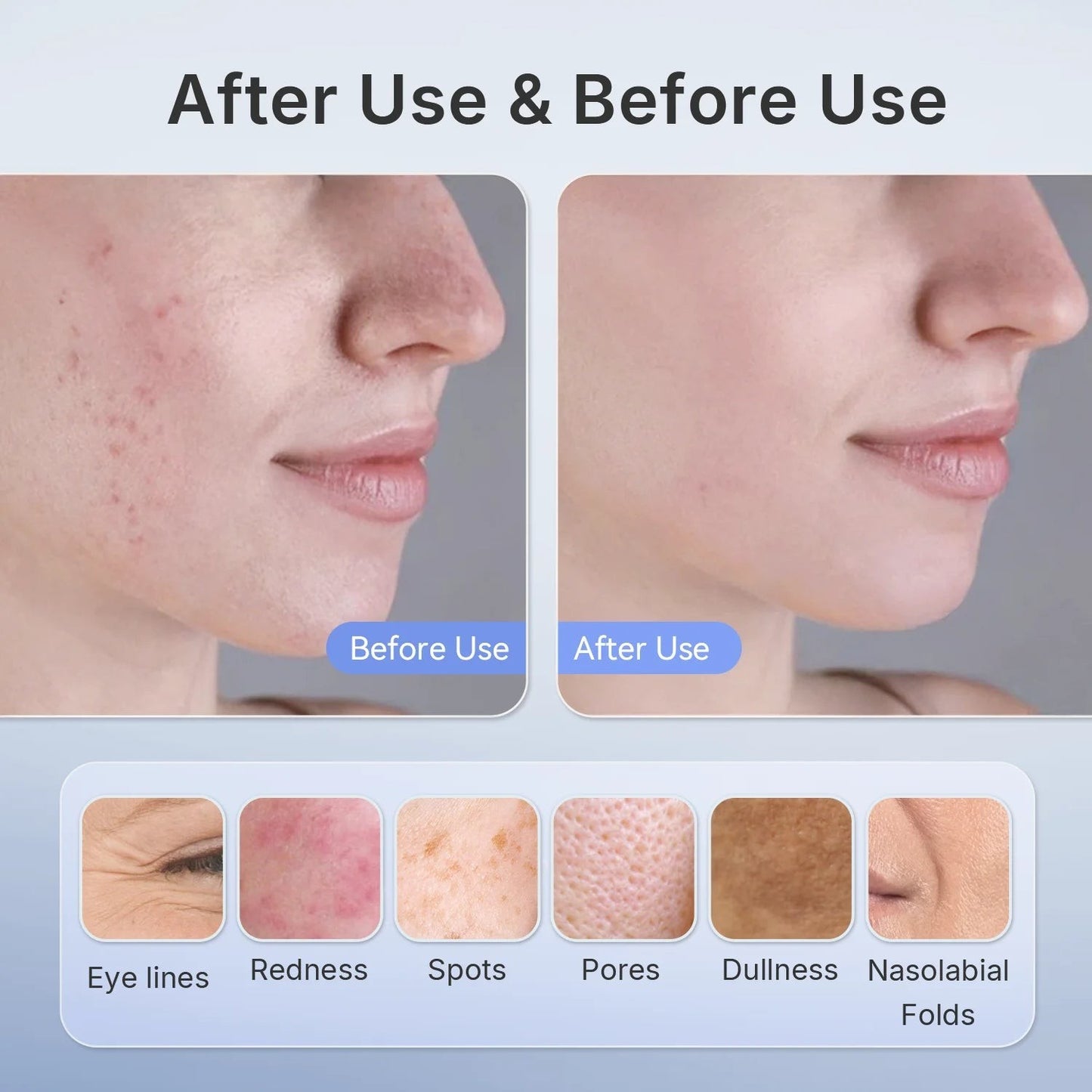 AuraLight 4-in-1 Facial Shield