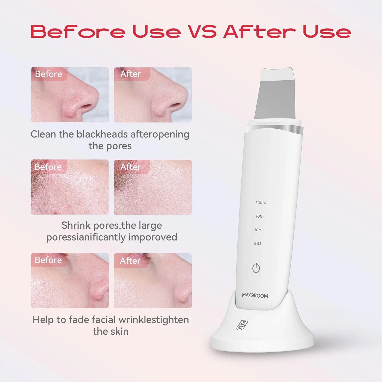 VelvetSkin Exfoliating Device